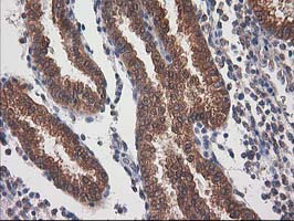 DSTN / Destrin Antibody - IHC of paraffin-embedded Human endometrium tissue using anti-DSTN mouse monoclonal antibody.