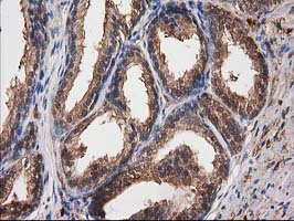 DSTN / Destrin Antibody - IHC of paraffin-embedded Human prostate tissue using anti-DSTN mouse monoclonal antibody.