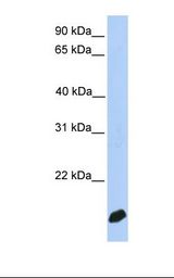 DSTN / Destrin Antibody - MCF7 cell lysate. Antibody concentration: 1.0 ug/ml. Gel concentration: 12%.  This image was taken for the unconjugated form of this product. Other forms have not been tested.