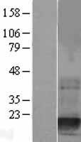 DSTN / Destrin Protein - Western validation with an anti-DDK antibody * L: Control HEK293 lysate R: Over-expression lysate