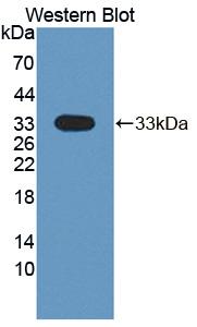 DSTYK / RIPK5 Antibody - Western blot of DSTYK / RIPK5 antibody.