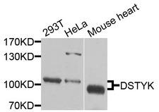 DSTYK / RIPK5 Antibody - Western blot analysis of extracts of various cells.