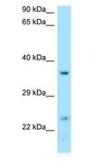 DTD1 Antibody - DTD1 antibody Western Blot of Fetal Liver.  This image was taken for the unconjugated form of this product. Other forms have not been tested.