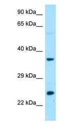 DTD1 Antibody - DTD1 antibody Western Blot of Fetal Liver.  This image was taken for the unconjugated form of this product. Other forms have not been tested.