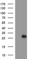 DTD1 Antibody - HEK293T cells were transfected with the pCMV6-ENTRY control (Left lane) or pCMV6-ENTRY DTD1 (Right lane) cDNA for 48 hrs and lysed. Equivalent amounts of cell lysates (5 ug per lane) were separated by SDS-PAGE and immunoblotted with anti-DTD1.