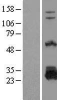 DTD1 Protein - Western validation with an anti-DDK antibody * L: Control HEK293 lysate R: Over-expression lysate