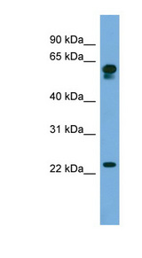 DTD2 Antibody - C14orf126 antibody Western blot of 721_B cell lysate. This image was taken for the unconjugated form of this product. Other forms have not been tested.