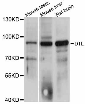 DTL / CDT2 Antibody - Western blot analysis of extracts of various cell lines, using DTL antibody at 1:3000 dilution. The secondary antibody used was an HRP Goat Anti-Rabbit IgG (H+L) at 1:10000 dilution. Lysates were loaded 25ug per lane and 3% nonfat dry milk in TBST was used for blocking. An ECL Kit was used for detection and the exposure time was 1s.