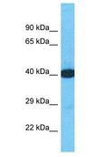 DTNA / Dystrobrevin Alpha Antibody - DTNA / Dystrobrevin Alpha antibody Western Blot of U937. Antibody dilution: 1 ug/ml.  This image was taken for the unconjugated form of this product. Other forms have not been tested.