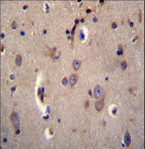 DTNA / Dystrobrevin Alpha Antibody - DTNA Antibody immunohistochemistry of formalin-fixed and paraffin-embedded human brain tissue followed by peroxidase-conjugated secondary antibody and DAB staining.