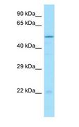 DTNA / Dystrobrevin Alpha Antibody - DTNA / Dystrobrevin Alpha antibody Western Blot of HeLa.  This image was taken for the unconjugated form of this product. Other forms have not been tested.