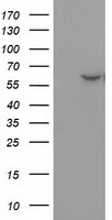 DTNA / Dystrobrevin Alpha Antibody - HEK293T cells were transfected with the pCMV6-ENTRY control (Left lane) or pCMV6-ENTRY DTNA (Right lane) cDNA for 48 hrs and lysed. Equivalent amounts of cell lysates (5 ug per lane) were separated by SDS-PAGE and immunoblotted with anti-DTNA.