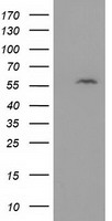 DTNA / Dystrobrevin Alpha Antibody - HEK293T cells were transfected with the pCMV6-ENTRY control (Left lane) or pCMV6-ENTRY DTNA (Right lane) cDNA for 48 hrs and lysed. Equivalent amounts of cell lysates (5 ug per lane) were separated by SDS-PAGE and immunoblotted with anti-DTNA.