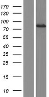 DTNA / Dystrobrevin Alpha Protein - Western validation with an anti-DDK antibody * L: Control HEK293 lysate R: Over-expression lysate