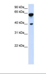 DTNB / Dystrobrevin Beta Antibody - Transfected 293T cell lysate. Antibody concentration: 1.0 ug/ml. Gel concentration: 12%.  This image was taken for the unconjugated form of this product. Other forms have not been tested.