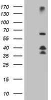 DTNB / Dystrobrevin Beta Antibody - HEK293T cells were transfected with the pCMV6-ENTRY control (Left lane) or pCMV6-ENTRY DTNB (Right lane) cDNA for 48 hrs and lysed. Equivalent amounts of cell lysates (5 ug per lane) were separated by SDS-PAGE and immunoblotted with anti-DTNB.