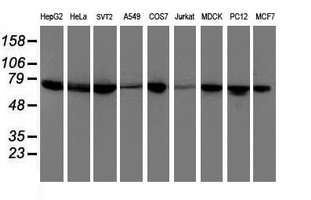 DTNB / Dystrobrevin Beta Antibody - Western blot of extracts (35 ug) from 9 different cell lines by using anti-DTNB monoclonal antibody.