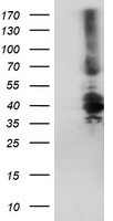 DTNB / Dystrobrevin Beta Antibody - HEK293T cells were transfected with the pCMV6-ENTRY control (Left lane) or pCMV6-ENTRY DTNB (Right lane) cDNA for 48 hrs and lysed. Equivalent amounts of cell lysates (5 ug per lane) were separated by SDS-PAGE and immunoblotted with anti-DTNB.