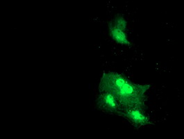 DTNB / Dystrobrevin Beta Antibody - Anti-DTNB mouse monoclonal antibody immunofluorescent staining of COS7 cells transiently transfected by pCMV6-ENTRY DTNB.