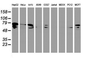 DTNB / Dystrobrevin Beta Antibody - Western blot of extracts (35ug) from 9 different cell lines by using anti-DTNB monoclonal antibody.