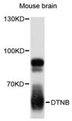 DTNB / Dystrobrevin Beta Antibody - Western blot analysis of extracts of mouse brain, using DTNB antibody at 1:3000 dilution. The secondary antibody used was an HRP Goat Anti-Rabbit IgG (H+L) at 1:10000 dilution. Lysates were loaded 25ug per lane and 3% nonfat dry milk in TBST was used for blocking. An ECL Kit was used for detection and the exposure time was 10s.