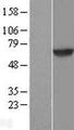 DTNB / Dystrobrevin Beta Protein - Western validation with an anti-DDK antibody * L: Control HEK293 lysate R: Over-expression lysate