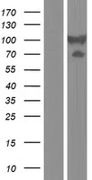 DTNB / Dystrobrevin Beta Protein - Western validation with an anti-DDK antibody * L: Control HEK293 lysate R: Over-expression lysate