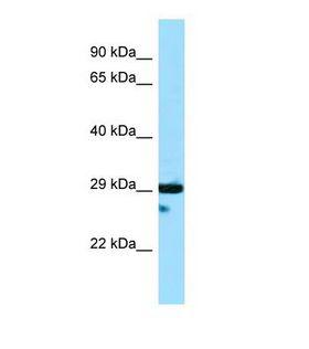 DTNBP1 / Dysbindin Antibody - Western blot of Human HepG2. DTNBP1 antibody dilution 1.0 ug/ml.  This image was taken for the unconjugated form of this product. Other forms have not been tested.