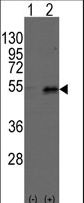 DTNBP1 / Dysbindin Antibody - Western blot of Dtnbp1(arrow) using rabbit polyclonal Dysbindin(Dtnbp1) Antibody. 293 cell lysates (2 ug/lane) either nontransfected (Lane 1) or transiently transfected with the Dtnbp1 gene (Lane 2) (Origene Technologies).