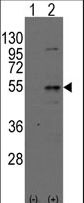 DTNBP1 / Dysbindin Antibody - Western blot of Dtnbpt(arrow) using rabbit polyclonal Dysbindin(Dtnbp1) Antibody. 293 cell lysates (2 ug/lane) either nontransfected (Lane 1) or transiently transfected with the Dtnbpt gene (Lane 2) (Origene Technologies).