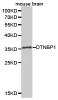 DTNBP1 / Dysbindin Antibody - Western blot of extracts of mouse brain cell lines, using DTNBP1 antibody.