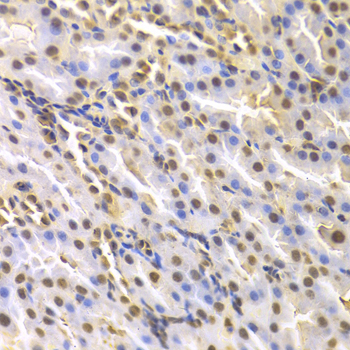 DTNBP1 / Dysbindin Antibody - Immunohistochemistry of paraffin-embedded rat kidney tissue.