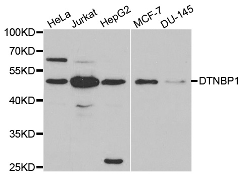 DTNBP1 / Dysbindin Antibody - Western blot analysis of extracts of various cell lines, using DTNBP1 antibody at 1:1000 dilution. The secondary antibody used was an HRP Goat Anti-Rabbit IgG (H+L) at 1:10000 dilution. Lysates were loaded 25ug per lane and 3% nonfat dry milk in TBST was used for blocking.