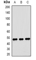 DTNBP1 / Dysbindin Antibody - Western blot analysis of Dysbindin 1 expression in Jurkat (A); HepG2 (B); MCF7 (C) whole cell lysates.