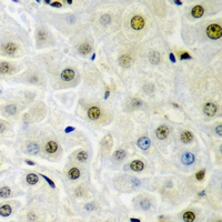 DTNBP1 / Dysbindin Antibody - Immunohistochemical analysis of Dysbindin 1 staining in rat liver formalin fixed paraffin embedded tissue section. The section was pre-treated using heat mediated antigen retrieval with sodium citrate buffer (pH 6.0). The section was then incubated with the antibody at room temperature and detected using an HRP conjugated compact polymer system. DAB was used as the chromogen. The section was then counterstained with hematoxylin and mounted with DPX.