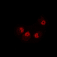 DTNBP1 / Dysbindin Antibody - Immunofluorescent analysis of Dysbindin 1 staining in MCF7 cells. Formalin-fixed cells were permeabilized with 0.1% Triton X-100 in TBS for 5-10 minutes and blocked with 3% BSA-PBS for 30 minutes at room temperature. Cells were probed with the primary antibody in 3% BSA-PBS and incubated overnight at 4 deg C in a humidified chamber. Cells were washed with PBST and incubated with a DyLight 594-conjugated secondary antibody (red) in PBS at room temperature in the dark.