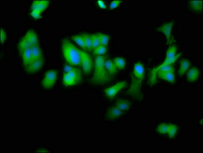 DTNBP1 / Dysbindin Antibody - Immunofluorescence staining of MCF-7 cells at a dilution of 1:100, counter-stained with DAPI. The cells were fixed in 4% formaldehyde, permeabilized using 0.2% Triton X-100 and blocked in 10% normal Goat Serum. The cells were then incubated with the antibody overnight at 4 °C.The secondary antibody was Alexa Fluor 488-congugated AffiniPure Goat Anti-Rabbit IgG (H+L) .