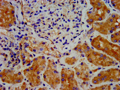 DTNBP1 / Dysbindin Antibody - Immunohistochemistry image at a dilution of 1:300 and staining in paraffin-embedded human kidney tissue performed on a Leica BondTM system. After dewaxing and hydration, antigen retrieval was mediated by high pressure in a citrate buffer (pH 6.0) . Section was blocked with 10% normal goat serum 30min at RT. Then primary antibody (1% BSA) was incubated at 4 °C overnight. The primary is detected by a biotinylated secondary antibody and visualized using an HRP conjugated SP system.