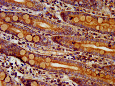 DTNBP1 / Dysbindin Antibody - Immunohistochemistry image at a dilution of 1:300 and staining in paraffin-embedded human small intestine tissue performed on a Leica BondTM system. After dewaxing and hydration, antigen retrieval was mediated by high pressure in a citrate buffer (pH 6.0) . Section was blocked with 10% normal goat serum 30min at RT. Then primary antibody (1% BSA) was incubated at 4 °C overnight. The primary is detected by a biotinylated secondary antibody and visualized using an HRP conjugated SP system.