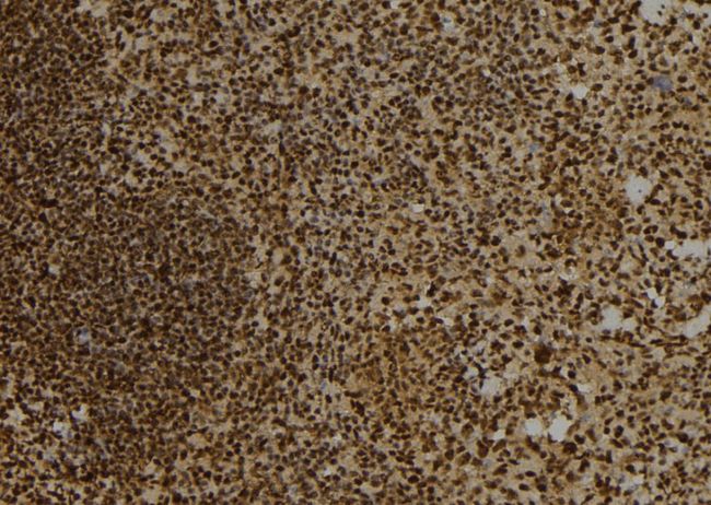 DTNBP1 / Dysbindin Antibody - 1:100 staining mouse spleen tissue by IHC-P. The sample was formaldehyde fixed and a heat mediated antigen retrieval step in citrate buffer was performed. The sample was then blocked and incubated with the antibody for 1.5 hours at 22°C. An HRP conjugated goat anti-rabbit antibody was used as the secondary.
