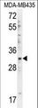 DTWD1 Antibody - DTWD1 Antibody western blot of MDA-MB435 cell line lysates (35 ug/lane). The DTWD1 antibody detected the DTWD1 protein (arrow).