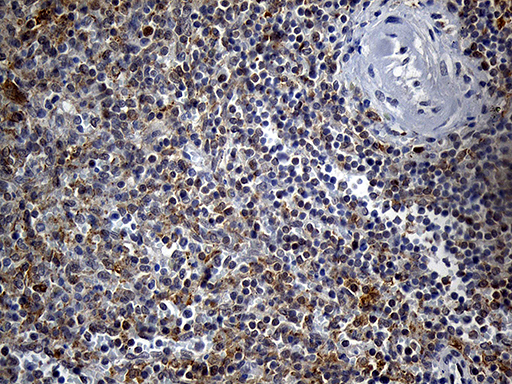 DTWD1 Antibody - Immunohistochemical staining of paraffin-embedded Human spleen tissue within the normal limits using anti-DTWD1 mouse monoclonal antibody. (Heat-induced epitope retrieval by 1mM EDTA in 10mM Tris buffer. (pH8.5) at 120°C for 3 min. (1:500)
