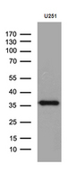 DTWD1 Antibody - Western blot analysis of extracts. (35ug) from cell lines and/or tissue lysates by using anti-DTWD1 monoclonal antibody. (1:500)