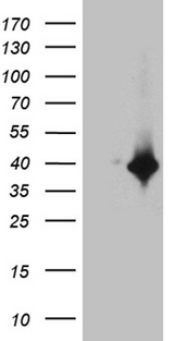 DTWD1 Antibody - HEK293T cells were transfected with the pCMV6-ENTRY control. (Left lane) or pCMV6-ENTRY DTWD1. (Right lane) cDNA for 48 hrs and lysed. Equivalent amounts of cell lysates. (5 ug per lane) were separated by SDS-PAGE and immunoblotted with anti-DTWD1. (1:2000)