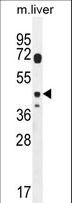 DTWD2 Antibody - DTWD2 Antibody western blot of mouse liver tissue lysates (35 ug/lane). The DTWD2 antibody detected the DTWD2 protein (arrow).