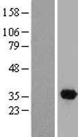 DTWD2 Protein - Western validation with an anti-DDK antibody * L: Control HEK293 lysate R: Over-expression lysate