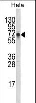 DTX1 / Deltex Antibody - Western blot of DTX1 Antibody in HeLa cell line lysates (35 ug/lane). DTX1 (arrow) was detected using the purified antibody.