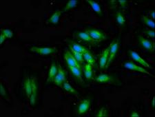 DTX1 / Deltex Antibody - Immunofluorescent analysis of Hela cells at a dilution of 1:100 and Alexa Fluor 488-congugated AffiniPure Goat Anti-Rabbit IgG(H+L)