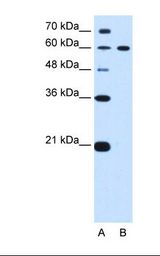 DTX2 Antibody - Lane A: Marker. Lane B: HepG2 cell lysate. Antibody concentration: 0.25 ug/ml. Gel concentration: 12%.  This image was taken for the unconjugated form of this product. Other forms have not been tested.
