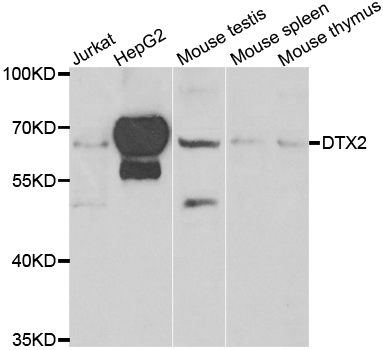 DTX2 Antibody - Western blot analysis of extracts of various cell lines.
